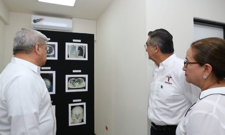 El Hospital Infantil de Tamaulipas contará con un equipo de Tomografía Axial Computarizada (TAC), con una inversión de 2O millones cien mil pesos.
